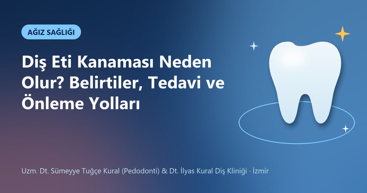 Diş Eti Kanaması Neden Olur? Belirtiler, Tedavi ve Önleme Yolları – Kural Diş Kliniği blog kapak görseli