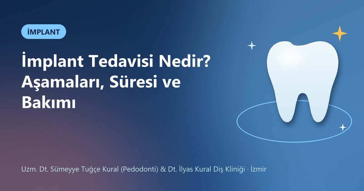 İmplant Tedavisi Nedir? Aşamaları, Süresi ve Bakımı – Kural Diş Kliniği blog kapak görseli