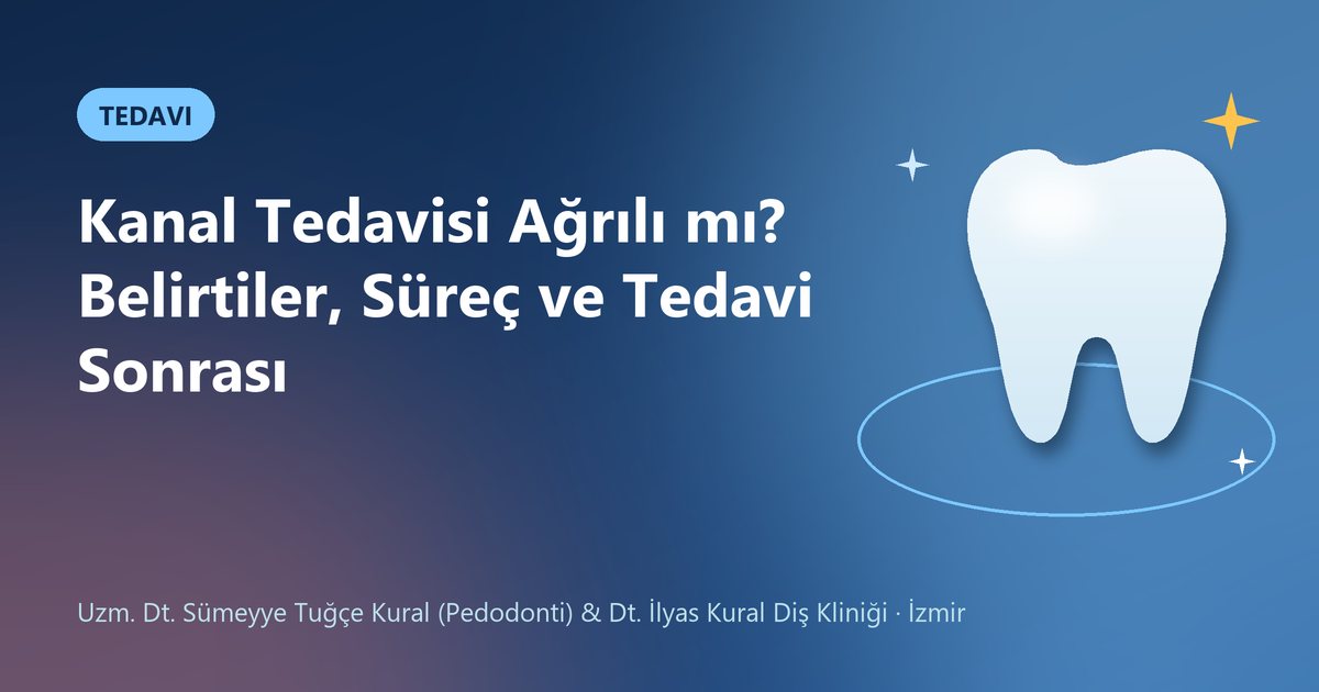 Kanal Tedavisi Ağrılı mı? Belirtiler, Süreç ve Tedavi Sonrası – Kural Diş Kliniği blog kapak görseli